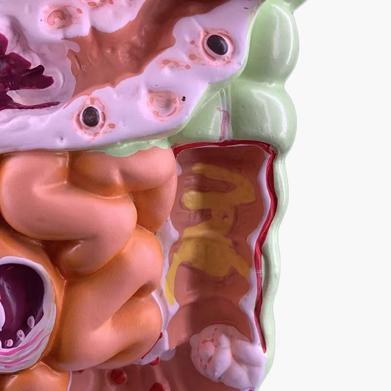 Human Digestive System Model Stomach Anatomy Large Intestine Cecum Rectum Duodenum Human Internal Organs Structure Model